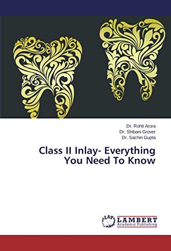 Class II Inlay- Everything You Need to Know