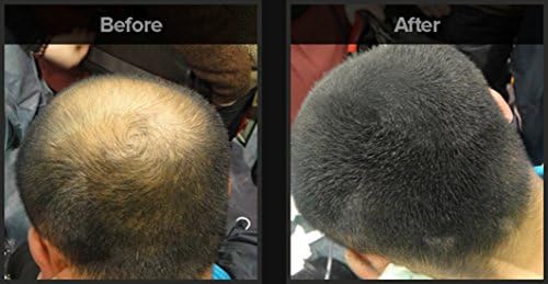 FixOFit Hair Building Fibers (8grams, Light Brown)