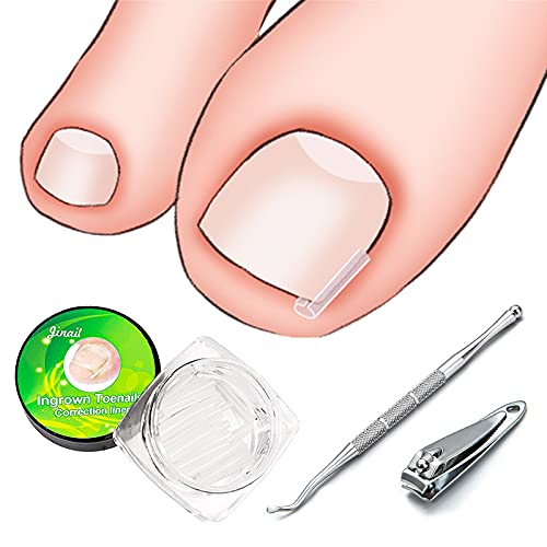 N C 50PCS Ingrown Toenail Corrector Strips Silicone Nail Pads Kit Thick Paronychia Curved Correction Pedicure Tool for Foot Care (50PCS)