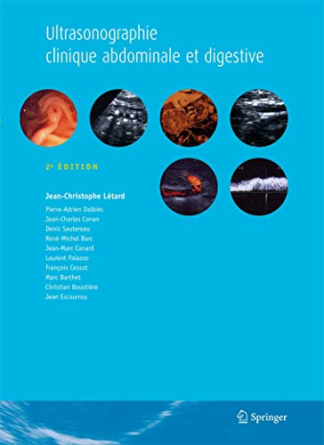 Ultrasonographie clinique abdominale et digestive