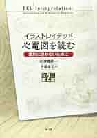 イラストレイテッド 心電図を読む(改訂第2版): 鑑別に迷わない
