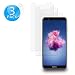 Produktbild De.Zev Huawei P Smart 2018 Panzerglas Schutzfolie, 3 Stück Huawei P Smart Panzerglasfolie, 9H Härte/Anti-Kratzen/Ultra-klar, 2.5D Touch Huawei P Smart 2018 Displayschutzfolie-Transparenz