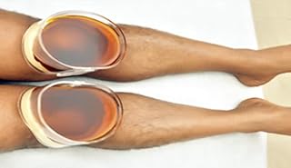 Atmiya Surgical Janu Basti Therapy Module – 2 Pcs (1 Pair) | Transparent Acrylic, Standard Size Ayurvedic Panchkarma Instr...