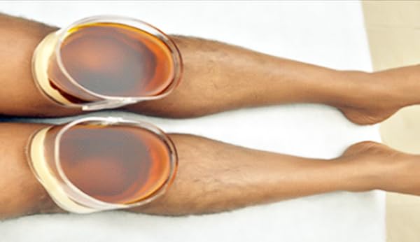 Image of Janu Basti Therapy Module - 2 Pcs (1 Pair) | Transparent Acrylic, Standard Size Ayurvedic Panchkarma Instrument for Knee Therapy