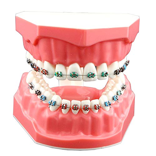 Can Orthodontic Treatment Help with Jaw Alignment Problems