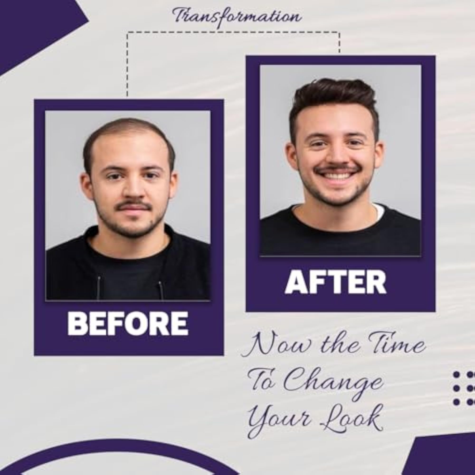 Men's Human Hair Patch Toupee Wigs, Hair Replacement Systems