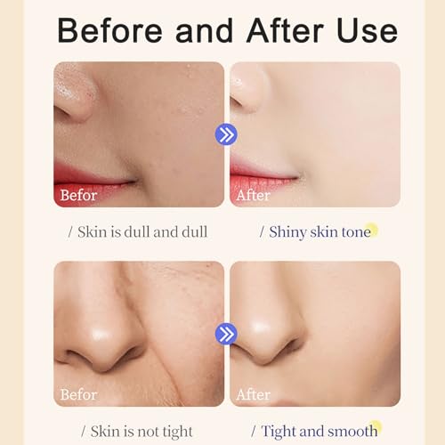 Retinol Face Cream with Hyaluronic Acid & Vitamin E - Collagen Cream - Anti Wrinkle Face Cream - Skin Lightening Cream - Dark Spot Remover - Anti Aging Face Cream - Night Cream for Women - Image 7