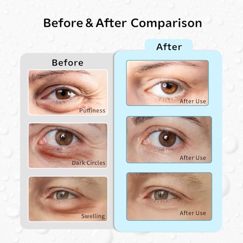 Image of Gel Ice Pack Reusable, Cooling Eye Pads and Patches, Hot and Cold Eye Pads - Soothing, Revitalizing, Puffiness, Refresh, Relieves Stress, Relax, Relieves Puffiness and Tension(2 Crabs+2 Pandas)