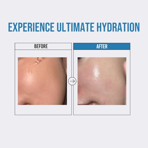 Jumiso Waterfull Hyaluronic Acid Serum 1.69 fl.oz / 50ml | Face Moisturizer, Facial Hydrating Serum for All Skin Types, Moisture Booster for Dry Skin | Vegan, Fragrance-Free