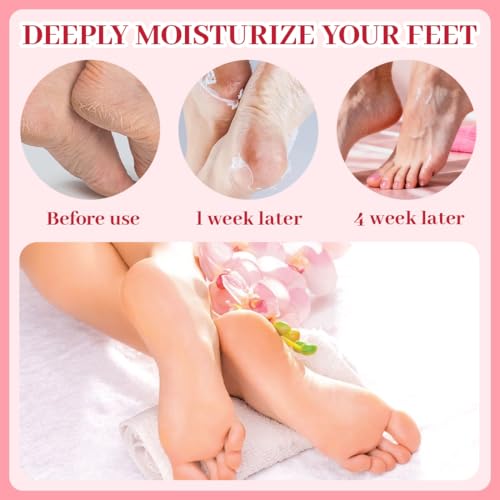 PQUELM Máscara nutritiva para pies de 9 piezas, máscara para pies con niacinamida, calcetines con crema para, crema hidratante, cuidado para pies secos y agrietados (melocotón + cereza + fresa) - imagen 6