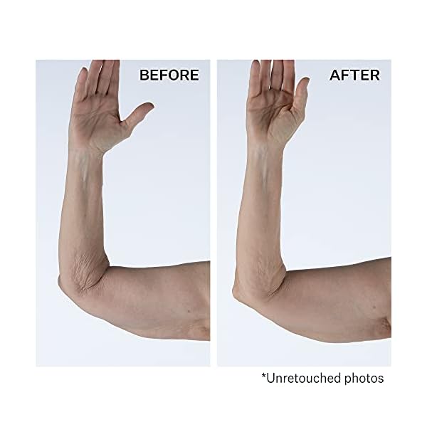 StriVectin Tighten & Lift Crepe Control Tightening Body Cream for Firmer, Brighter Arms & Legs, 6.7 Fl Oz