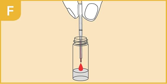 Prima Coeliac Gluten Sensitivity Home Test for IGA and IgG Antibodies | Results in 10 Minutes