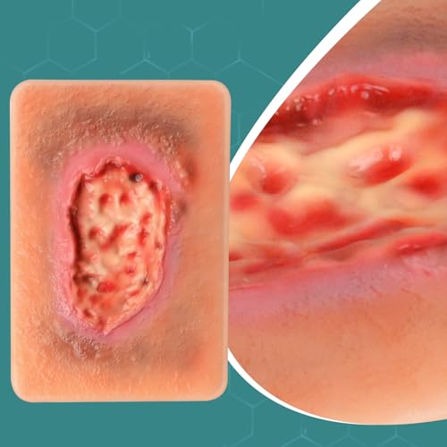 Image of Wet Necrotic Wound Simulation Model