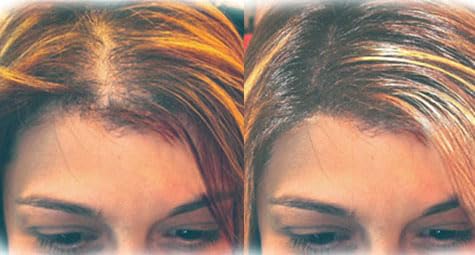 Hair Building Fibers 100% Wool - Natural Keratin. Size: 1/2 a Pound (227Grams) Bulk Refill Pack 60-80% SAVINGS. Thinning Hair/Bald Spots Toppikk, Sure Thick & Bosley. (Medium Brown, 227 grams)