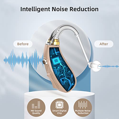 Hearing Aids For Seniors And Adults, Behind-The-Ear (Bte) Hearing Amplifier With Dsp Digital Chip & Dual Noise Cancellation, Digital Hearing Amplifier With Charging Dock (Pair) #TOP5