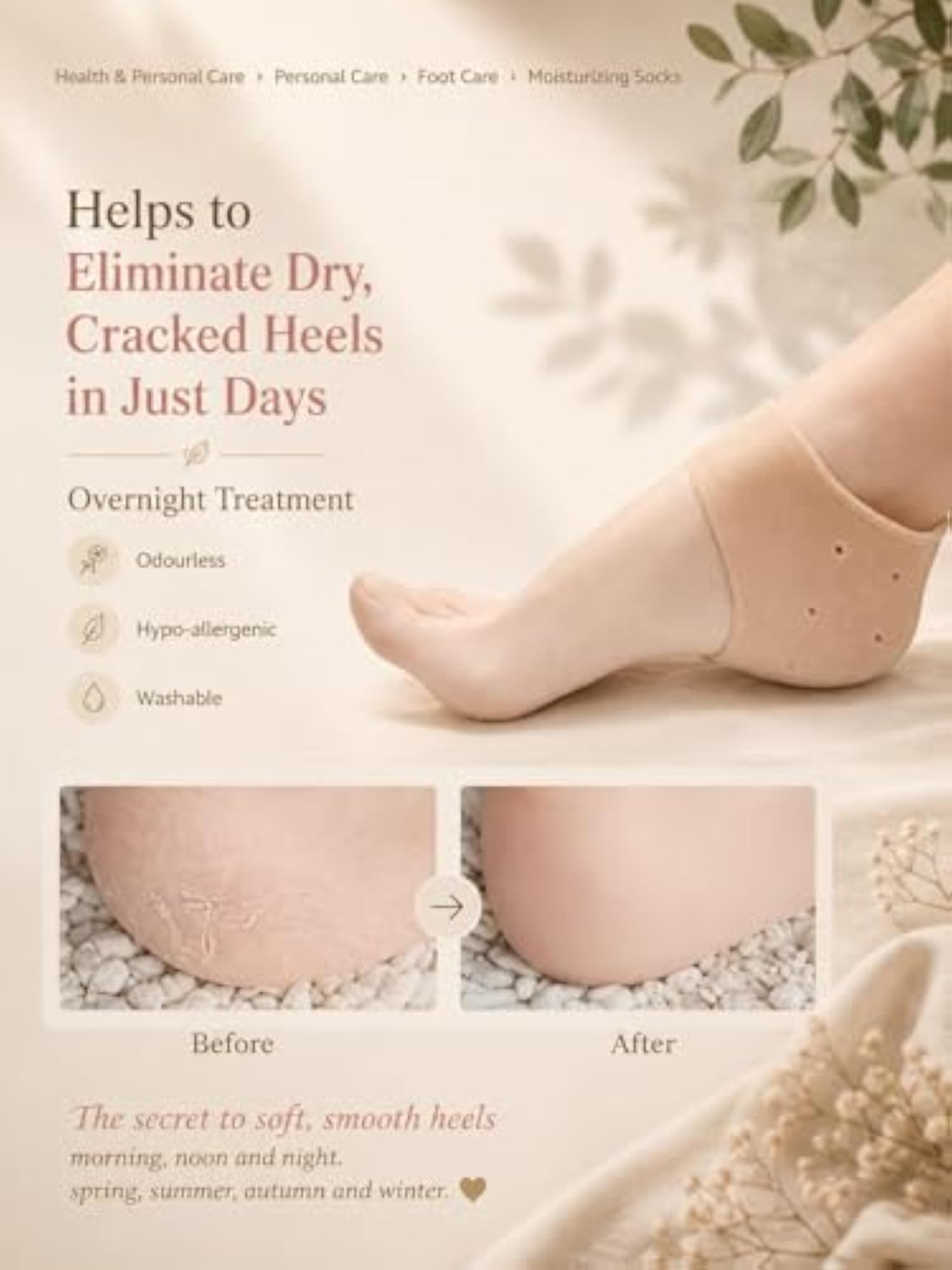 Silicone Gel Heel Sleeves for Cracked Heels