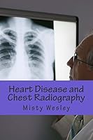 Heart Disease and Chest Radiography 1503121151 Book Cover