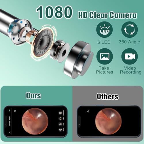 Image of New Ear Cleaner Tool Endoscope Otoscope, Ear Wax Cleaner with 1080p FHD Camera Ear wax remover Tool with Wifi Connection & 6 LED Lights Multi