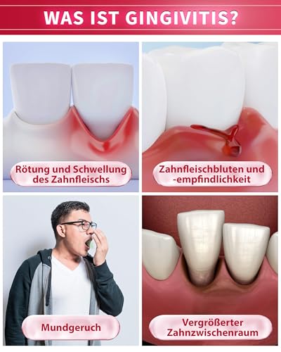 CAREDO Zahnpasta, Verhindert Zahnfleischentzündung, Repariert Empfindlichkeit und Zahnfleischbluten, Stärkt die Zahnfleischbarriere, Minzgeschmack, 100g Pro Tube – Bild 4