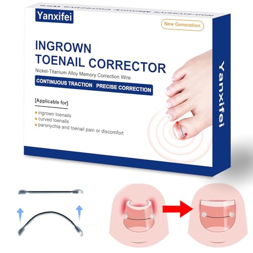 Nitinol Ingrown Toenail Corrector at Home Ingrown Toenail Treatment Curved Toenail Straightener Ingrown Toe Nail ReliefIngrown Toenail Removal Kit (1/2 In 11/16 In)