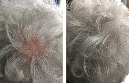 Caboki Hair Loss Concealer. All-Natural Hair Building Fiber. Make Thin Hair Look 10X Fuller Instantly. Eliminate the Appearance of Bald Spot and Thinning Hair (30G, 90-Day Supply). Silver/White