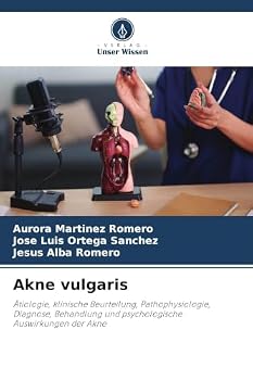 Akne vulgaris (German Edition)
