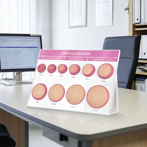 Image of Cervical Dilation Simulator Board with 1-10cm for Midwife and Doula Training, Gynecological Examination Model,Chart on Display Board Medical Education, and Birth Learning