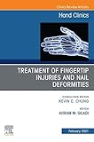  Treatment of fingertip injuries and nail deformities, An Issue of Hand Clinics, E-Book (The Clinics: Orthopedics 37) (English Edition)