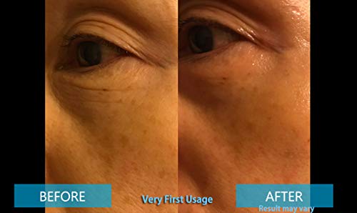 Pepplus Anti Aging Lifting Skincare Face Neck Wash Off Mask Treatment- 8 Treatment + Brush #TOP2