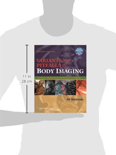 Variants and Pitfalls in Body Imaging: Thoracic, Abdominal and Women's Imaging