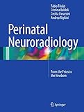 Perinatal Neuroradiology: From the Fetus to the Newborn