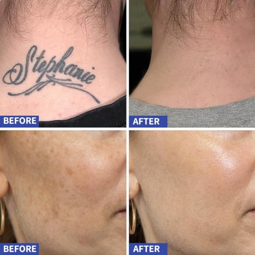 rechargeable blue pen with glasses medium white