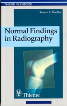 Paperback Normal Findings in Radiography Book