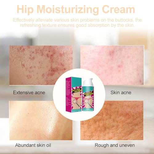 Creme gegen Akne für Gesäß, Reinigungscreme gegen Akne für Gesäß, 100 ml Creme für die Hüften, Entferner von Pickeln für die Hüften