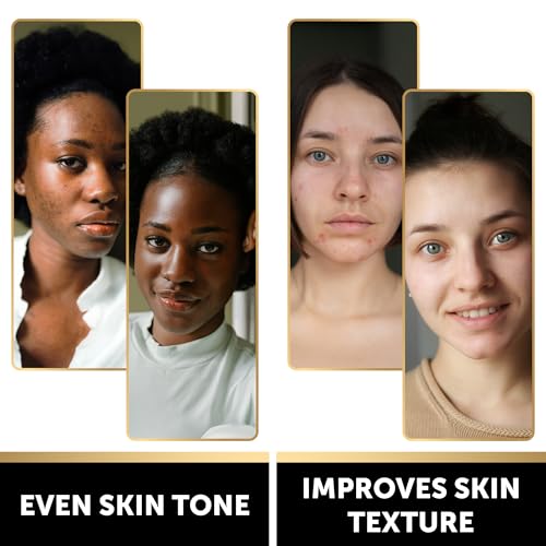 VALITIC Charcoal Kojic Acid Turmeric Black Soap Bar Dark Spot Remover for Body or Face Wash - 4 Pack