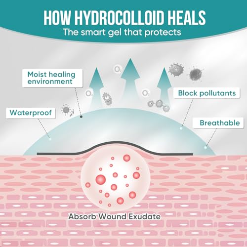 Image of Hydrocolloid Roll for Wound Care, Pimple Patch Roll Tape with Self-Adhesive, Bed Sore Bandages, Highly Absorbent for Burn, Blister, Acne Care, Waterproof (2in x 8ft) -Yellow