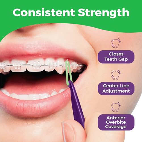 Medium Force 3.5 oz , 100 Pack - Neon : 1/4" inch Orthodontic Elastic Rubber Bands, 100 Pack, Neon, Medium Force 3.5 oz, Small Rubberbands for making bows, Dreadlocks, Dreads, Doll Hair, Braids, Horse Mane, Horse Tail, Fix Tooth Gap in teeth, Top Knots + FREE Elastic Placer for braces