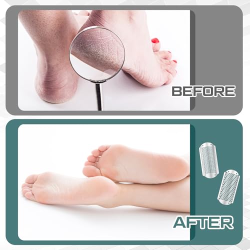 Image of Moxweyeni 12 Pack Silver Foot File Callus Remover Replacement Blades Metal Pedicure Rasp Hard Skin Remove Scrubber Stainless Steel 2 Designs Big /fine Hole for Detachable Foot Grater