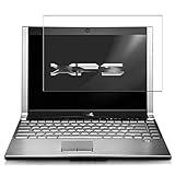 dell xps m1330 battery not charging Blasenfrei, fingerabdruckfrei, staubdicht. Keine klebrigen Rückstände beim Entfernen.
