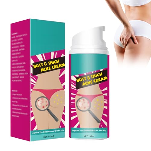 Crema De Acné De Cadera, Crema de limpieza para el acné para glúteos y muslos, Butt Acne Cream Crema Para Eliminar El Acné En Los Glúteos, Restaura La Piel Suave Y Tersa De Los Glúteos, shentiru