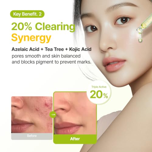 Image of PURITO Azelaic 10% Kojic Serum for Sensitive Skin, 1.01 fl.oz