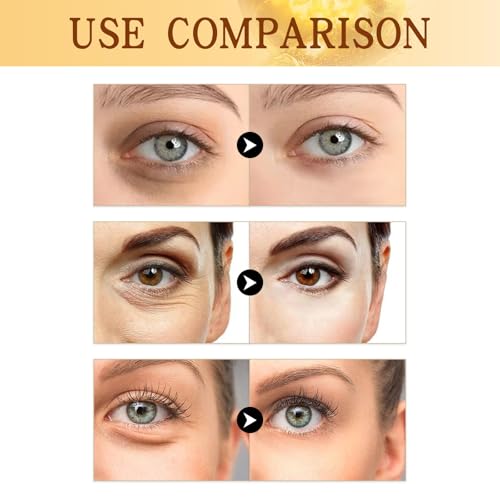 2PCS Vitamin C Eye Cream Stick,Glow Eye Stick,Under Eye Cream for Dark Circles and Puffy Eyes,Vitamin C Eye Creams,Anti Wrinkle Eye Cream,Eye Bags Remover,Eye Cream Anti Aging,Firming Eye Cream - Image 3