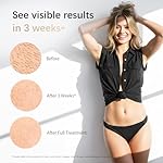 Laser Hair Removal, IPL Laser Hair Removal Device for Women & Men, Safe at-Home Nearly Painless 45°F Ice-Cooling Contact, Long-Lasting Result for Full Body & Face, Off-White - Image 3