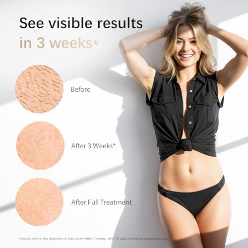 laser hair removal ipl laser hair removal device for women amp men safe at-home nearly painless 45f ice-cooling contact long-lasting result for full body amp face off-white