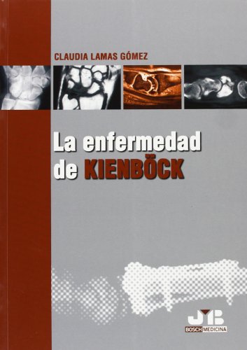 Enfermedad de Kienböck