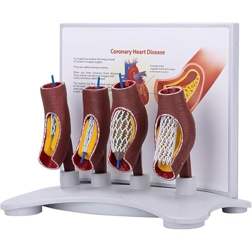 vrfvsdasAAS Modelo anatómico, Modelo de Bloqueo Vascular, Modelo anatómico Stent, demostración ampliación Vasos Humanos