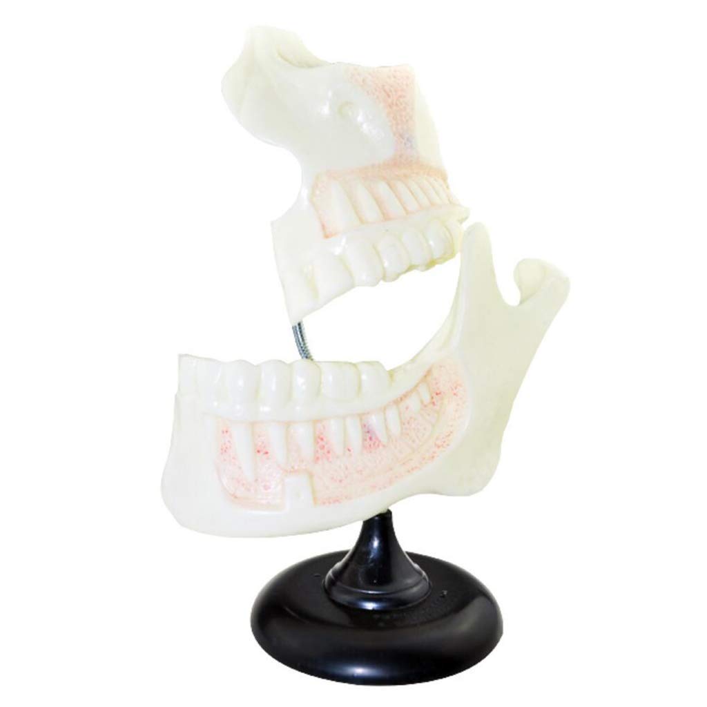 Study Model Dental Teeth Model-6X Enlarged Children's Dentition Model Science Dental Teaching Anatomy Model,Gums Standard Demonstration Teeth Model for Teaching Kids -Medical Educational Training.