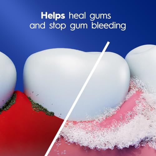 Crest Pro-Health Gum Detoxify Toothpaste 4.8 oz - Anticavity, Antibacterial Fluoride Toothpaste, Clinically Proven Gum, Sensitive, and Enamel Protection, Plaque Control - image 4