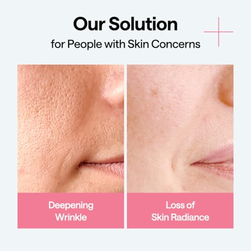 Image of MEDIHEAL Wrapping Serum Mask [Firming Volume] - Deep Elasticity Boosting Face Sheet Mask, Retinol & Adenosine - Smooths Fine Lines with Micro Liposome Delivery (10 Sheets)