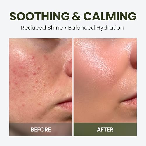Image of HyCicaMue Defence Cream, Calming Korean Moisturizer for Sensitive Skin, Redness Relief, Summer Sebum Control, Lightweight Hydrating, Cica Vegan Mucin Barrier Repair, Face Cream, 1.69 fl.oz